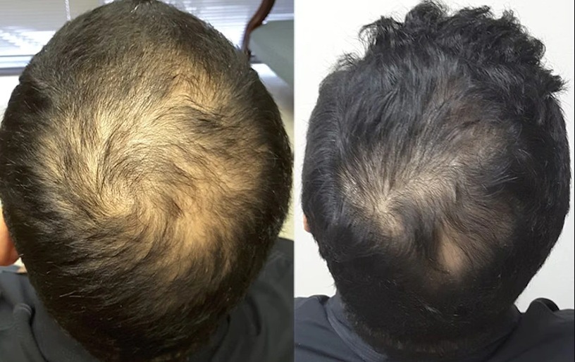 WhatsApp Image 2026-04-06 at 2.55.21 AM (1)